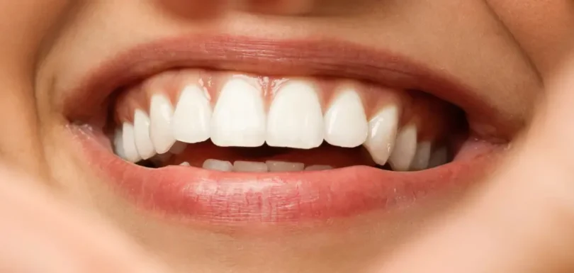 gülüş tasarımı neden önemlidir