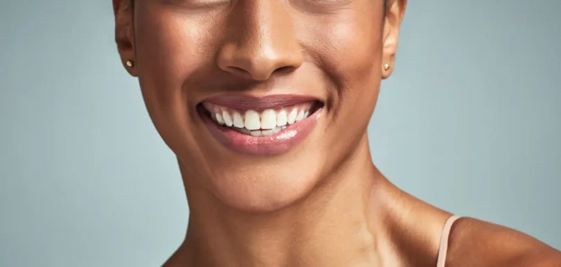 Gülüşünüzü Nasıl Güzelleştirebilirsiniz?