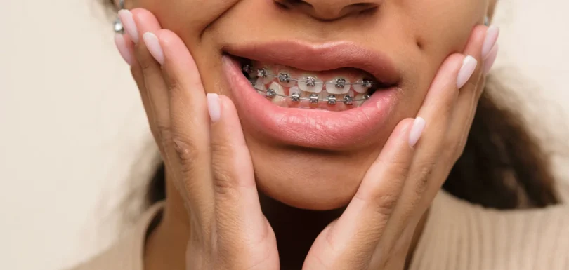 Diş Telim Yanağıma Batıyor Ne Yapmalıyım, Nasıl Geçer