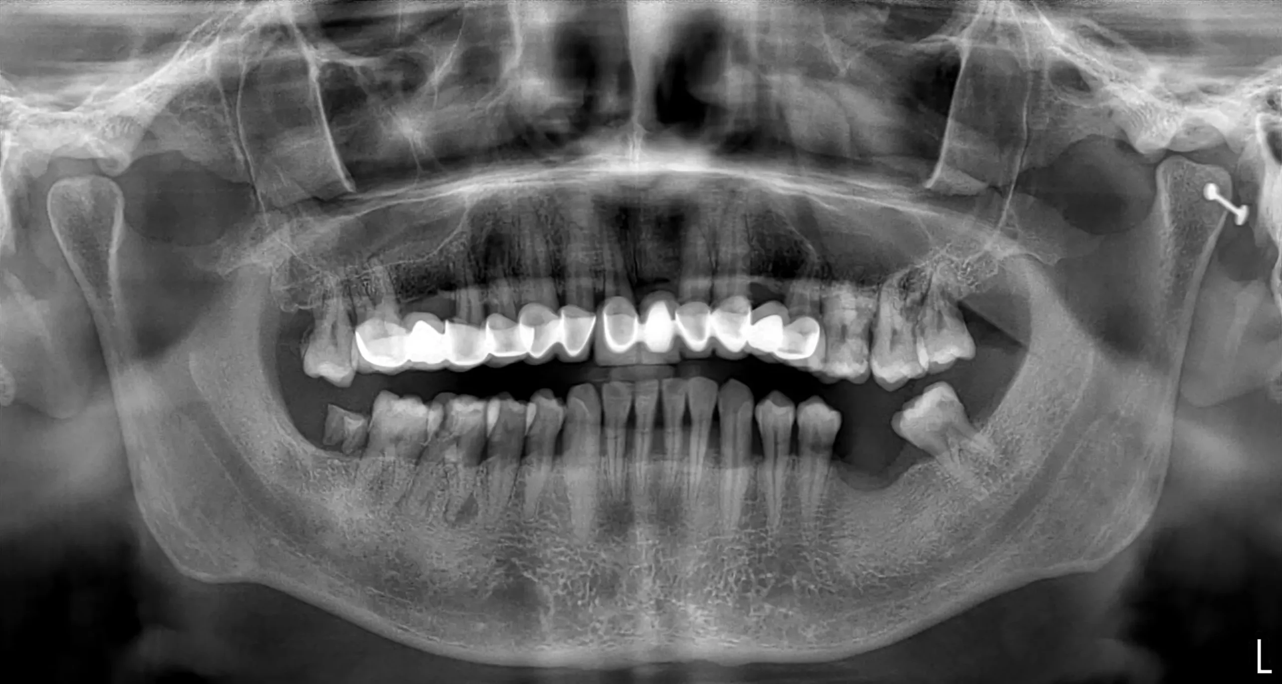 Arda M. - Röntgen X-ray